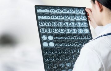 Un profesional médico de EuroEspes Health examina una serie de imágenes radiográficas que muestran cortes transversales del tórax. Las imágenes se muestran en una película negra y la persona lleva una bata blanca y el cabello oscuro recogido.